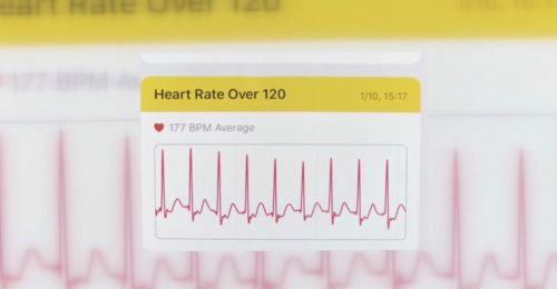 Heart rate monitor