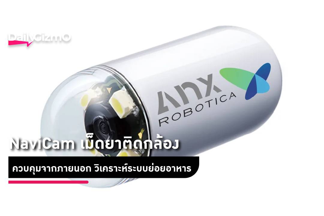 NaviCam: The Magnet-Controlled Capsule Camera Revolutionizing Internal ...